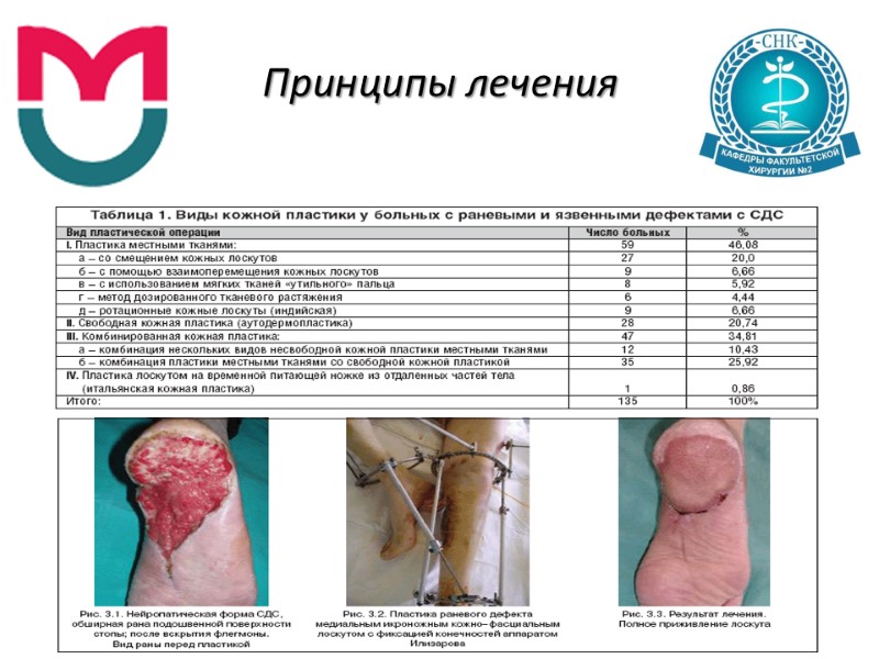 Принципы лечения